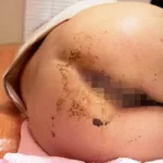 VXXD-006 変態マッサージ師のスゴ技で大量脱糞する女達 その他盗撮 Voyeur Other Baba★za★ Babii